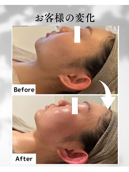 エムボーテ 太田店(M BEAUTE33)/顔筋小顔コルギ