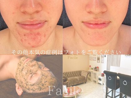 ファシル(Facile)の写真