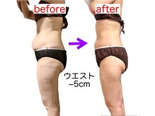 サロン ド ミコ(Salon de Mico)/40代　お腹くびれコース　14回