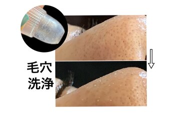 ビーバイビー(BBYB)/毛穴ニョキニョキ