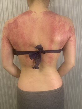 マリス(MARISS)/がちがち背中毒素だし<痩身>