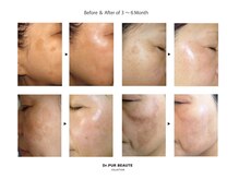 デアルーチェ(DEA LUCE)の雰囲気（しみシワ改善。純粋レチノールによる本格ピーリングケア。）