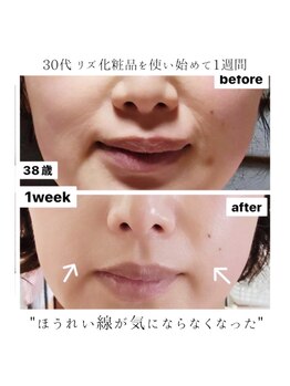 アンジー(an.g)/【40代からのたるみ改善】