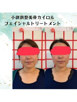 るりはな/小顔4