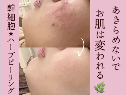 ワンカラット(ONE CARAT)の写真