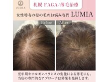 ルミア(LUMIA)