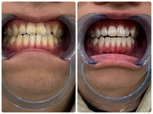 コナホワイトニング 神保町/神保町セルフホワイトニング