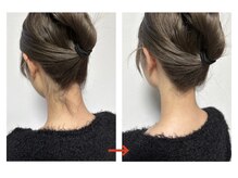 プラス 四条烏丸(Plus+)/【成人式・卒業式】うなじ脱毛