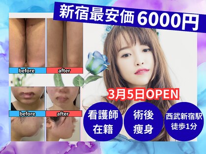 新宿術後インディバサロン【看護師監修/インディバ/ダウンタイムケア/都度払い】の写真