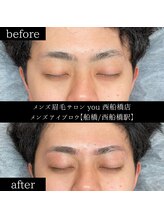 ユー 西船橋店(you)/ビフォーアフター写真
