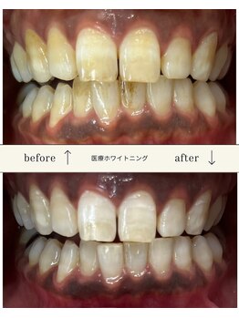 ブリス(Bliss)の写真/\ホワイトニング初心者さん集まれ/優しいアットホーム空間☆お悩みも話しやすい空間づくりにこだわり◎