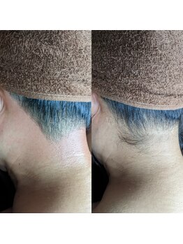 エンジェルワックス 蒲田店(Angel Wax)/【うなじワックス】