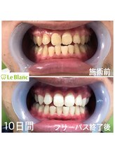 ルブラン 奈良店(Le Blanc)/男性のお客様！