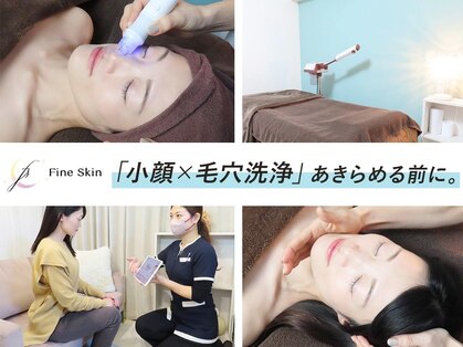 ファインスキン 新宿店(Fine Skin)の写真