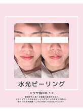 ソワナ(soina)/【神楽坂駅/フェイシャル/毛穴】