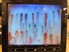 【水素吸入】　血流スコープ確認＆水素吸入30分