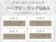 エヌエースキン センター北店(NA skin)の雰囲気（フォトギャラリーにお客様から多いご質問まとめております♪港北）