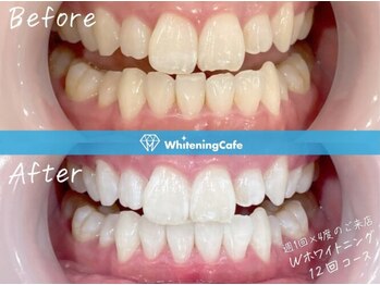 ホワイトニングカフェ 津田沼駅前店