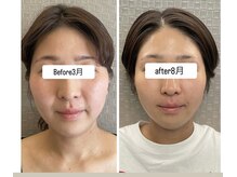 アリィ(Alii)/毎月のケアでスッキリ顔キープ