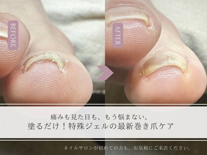 エン 中崎町(enn.)の写真