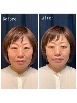 たくろう鍼灸院 豊田本院/Before&After