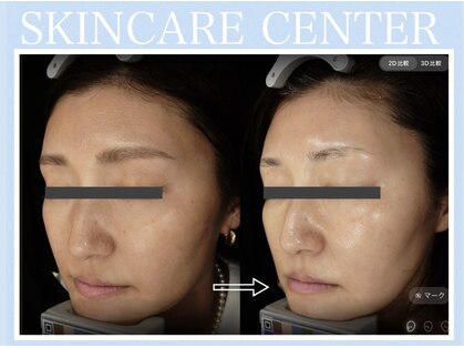 アンジェラックス スキンケアセンター 渋谷の写真