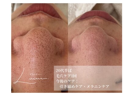 リュール(Lueur)の写真