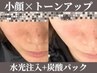 小顔×トーンアップ★針なし水光注入+選べる炭酸パック￥6600★