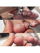 ネイルサロン ユーズ(USE.)/巻き爪ケア/フットケア