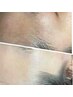 【初回限定】フェイシャルwaxで毛穴レス肌へ/産毛＆角質オフ◎＋首肩ケア付き