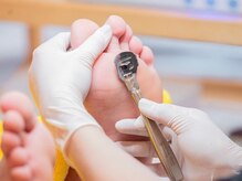 ドクターネイル爪革命 長崎佐世保店の雰囲気（角質ケアもお任せください◎）