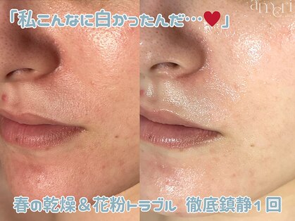 スキンラボアメリ(skin lab. ameri)の写真