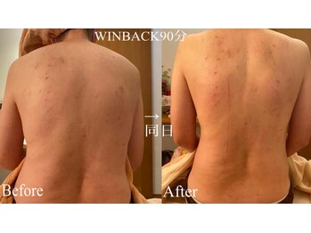 フセヤ &nbsp;エステティックアロマヨガスクール(FUSEYA)の写真/首肩こりがつらい方、日頃の家事育児で疲れた身体にご褒美を♪完全個室の空間で心身ともにリフレッシュ！