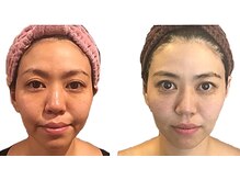 小顔整体研究所 KSラボ 藤が丘店/