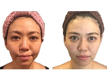 小顔整体研究所 KSラボ 藤が丘店/