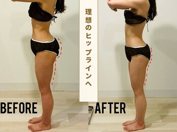リフロー(REFLOW)の写真/オンダマイクロ波リフト×極上リンパで美シルエットへ★専門知識に基づく施術で理想のボディラインを◎
