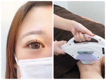 イードット(E.)/まつ毛×ワキ脱毛!!