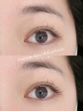 アミーラ(Amira)/フラットラッシュ