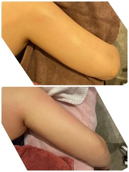 サロン ルイス アディクト(salon Lewis Addict)/