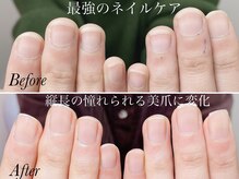 トゥインクリーネイルサロン(Twinkly Nail Salon)/【最強のネイルケア】1回お試し