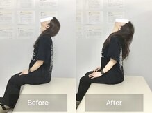 ナオル整体 国分寺院(NAORU整体)/20代女性【首肩・姿勢改善】