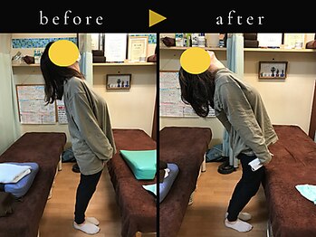 杉本接骨鍼灸院/若々しい背骨を取り戻す整体