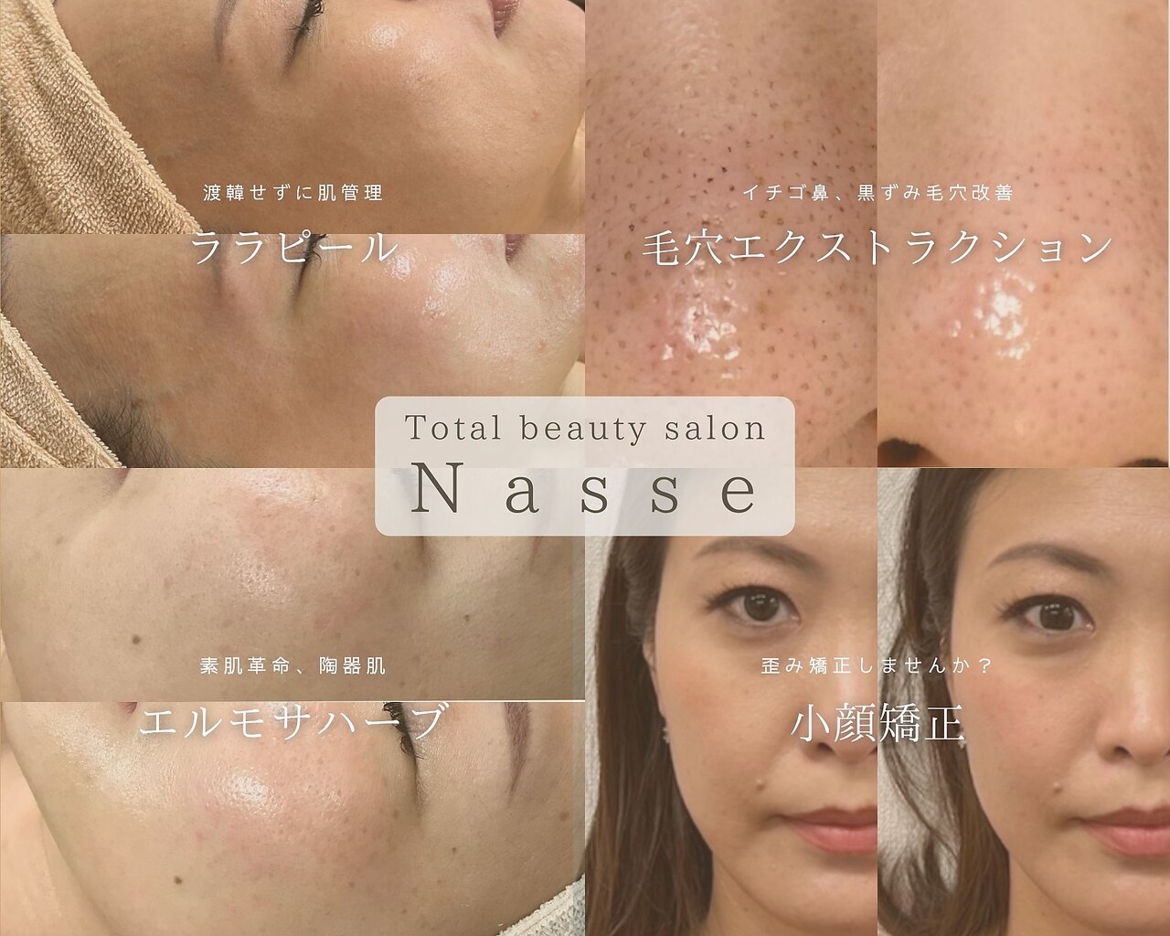 大濠公園駅で光フェイシャルが人気のエステサロン｜ホットペッパー