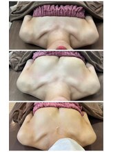 ロココ 豊田店(Rococo)/ビフォーアフター