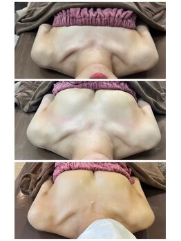 ロココ 豊田店(Rococo)/ビフォーアフター