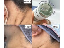 リメイク 広尾(REMAKE)/