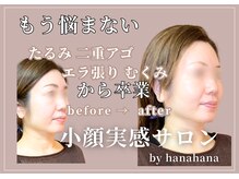 ハナハナ(hanahana)