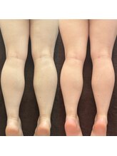 ケリービューティーサロン(kelly beauty salon)/足マッサージでむくみ防止！