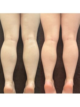 ケリービューティーサロン(kelly beauty salon)/足マッサージでむくみ防止！