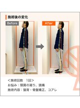 ただき接骨院 整体院 石原院/お悩み：頸肩の凝り、頭痛